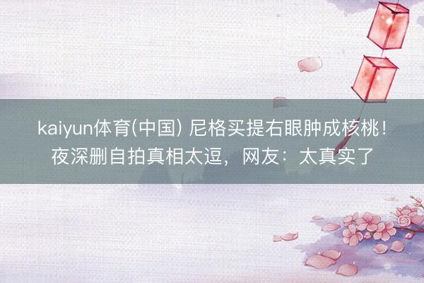 kaiyun体育(中国) 尼格买提右眼肿成核桃！夜深删自拍真相太逗，网友：太真实了