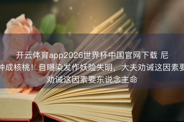 开云体育app2026世界杯中国官网下载 尼格买提右眼肿成核桃！自曝染发作妖险失明，大夫劝诫这因素要东说念主命